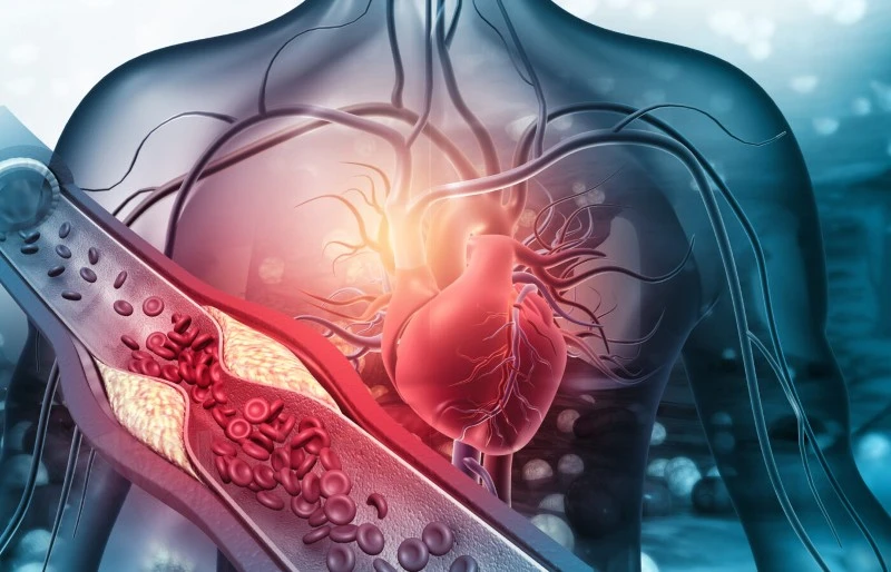 Cardiovascular Health Cardiovascular Health