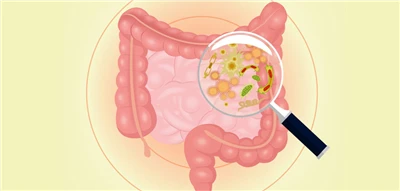 Memahami Kebenaran Tentang Ulkus Gastrointestinal Modern