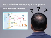 Peran Apa yang Dimainkan SFRP1 dalam Penelitian Pertumbuhan Rambut dan Rambut...